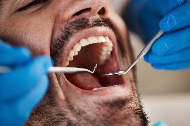 Best Broken or Cracked Tooth Emergency Dentist in Mount Vernon, IN