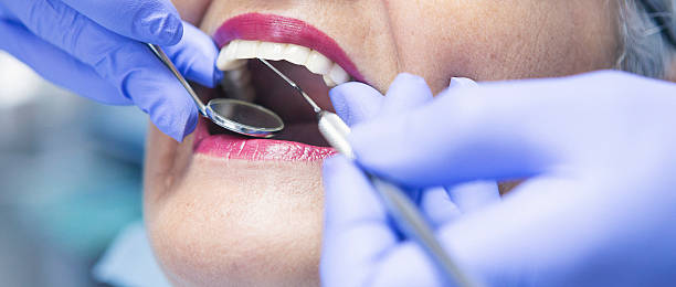 Best Emergency Dentist for Lost Fillings or Crowns in Mount Vernon, IN